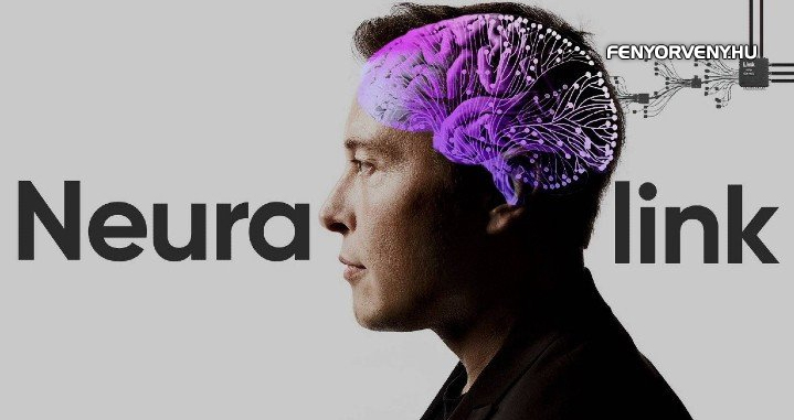 Elon Musk kísérleti agyi implantátumát már most több ezer ember ültetné magába